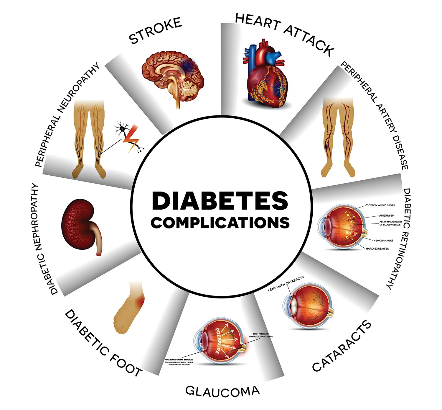 National Diabetes Month - Healthy Kansas City