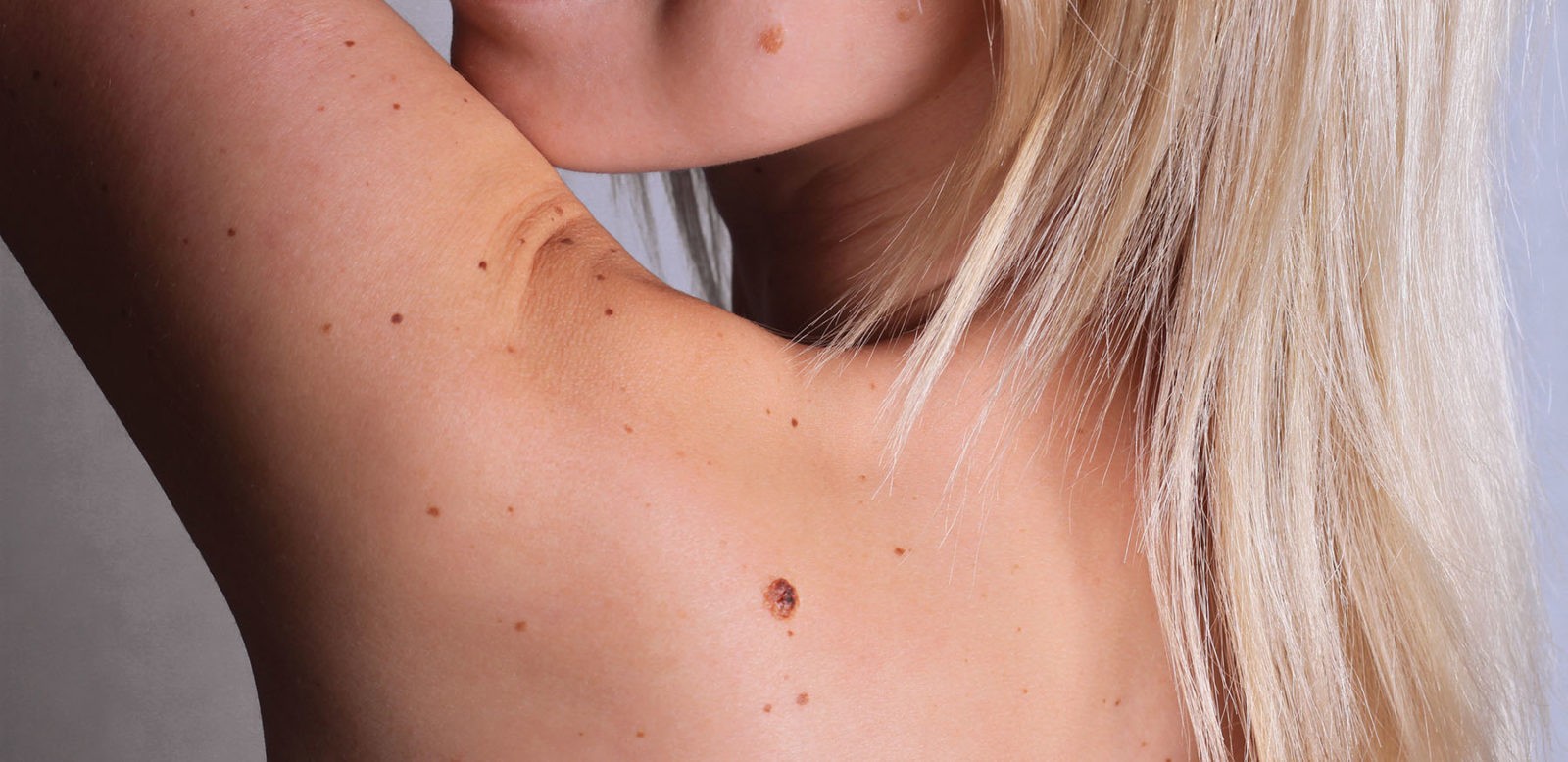 May Is Skin Cancer Awareness Month Healthy Kansas City