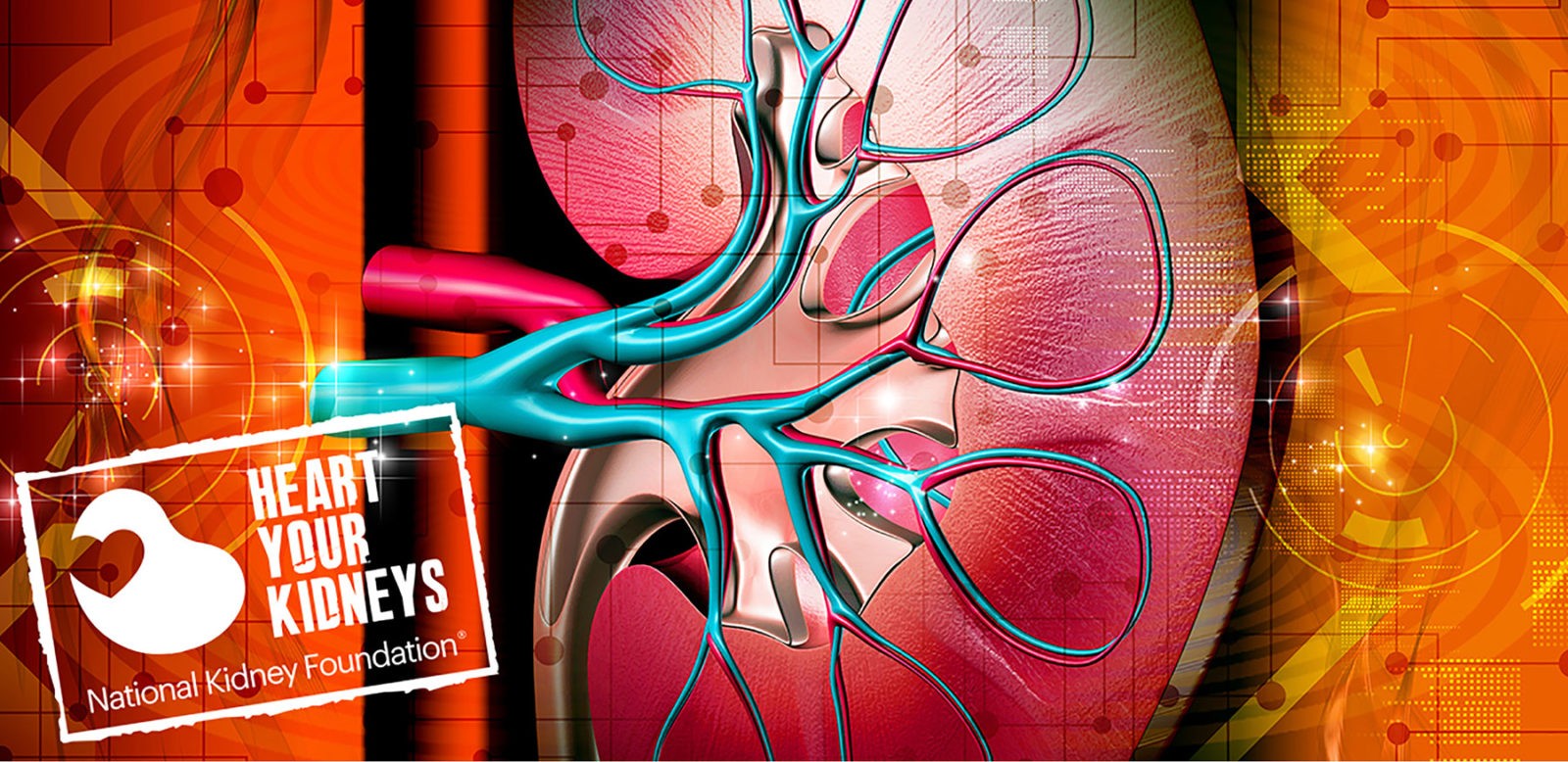 National Kidney Foundation Healthy Kansas City