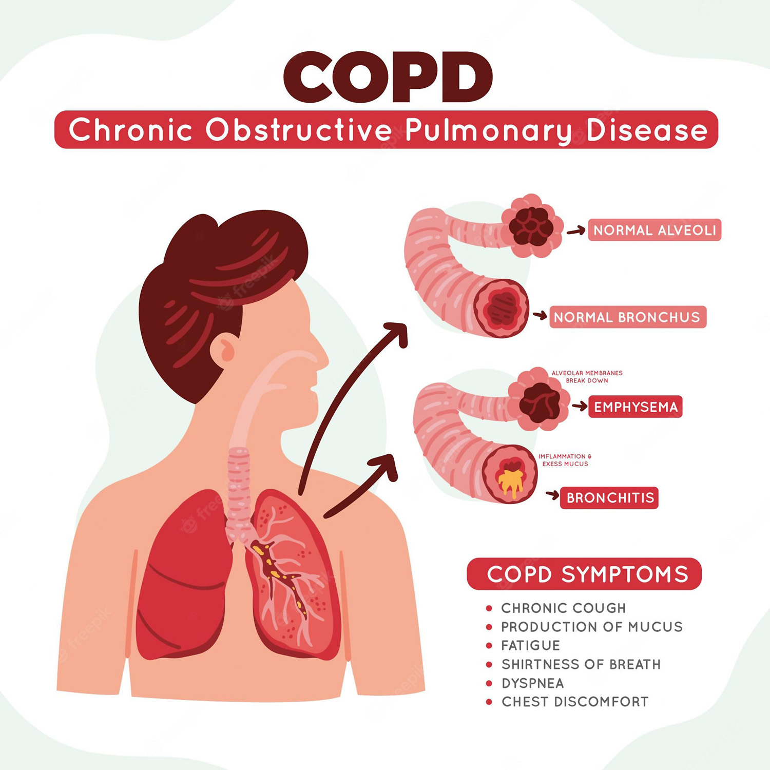 National COPD Awareness Month - Healthy Kansas City